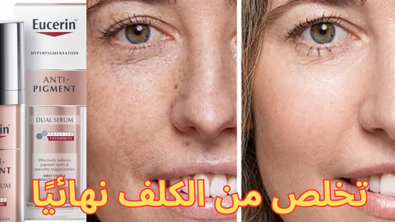 كيفية التخلص من فرط تصبغ البشرة (بقع الجلد الداكنة وتصبغات الشيخوخة)🌟 Eucerin Anti Pigment