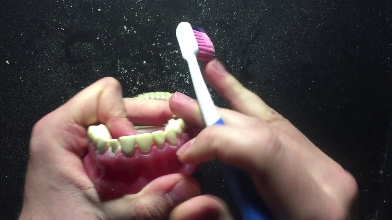 Üst Çene Lateral Diş Preparasyonu I Tooth Preparation I Maxillary Lateral Incisor