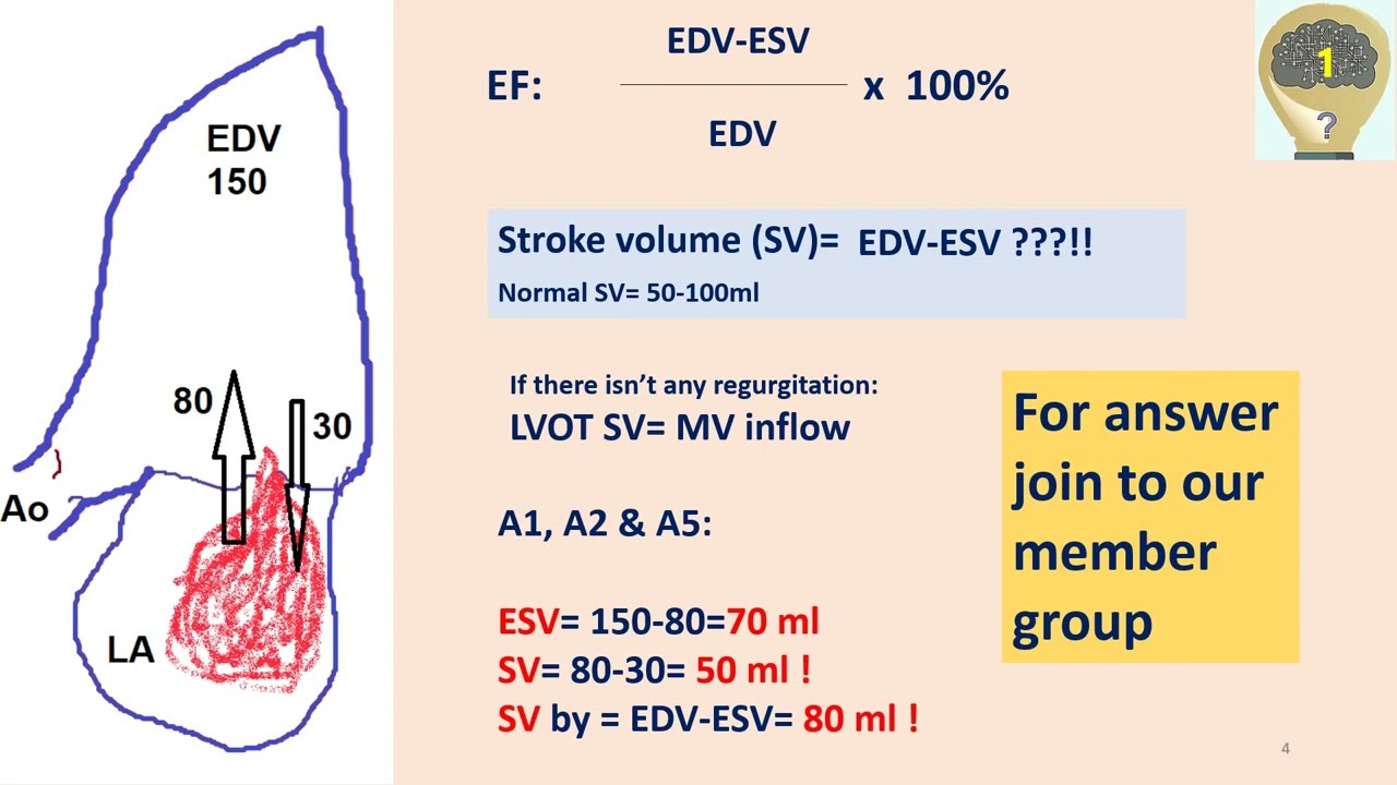 case study 1 hemodynamic
