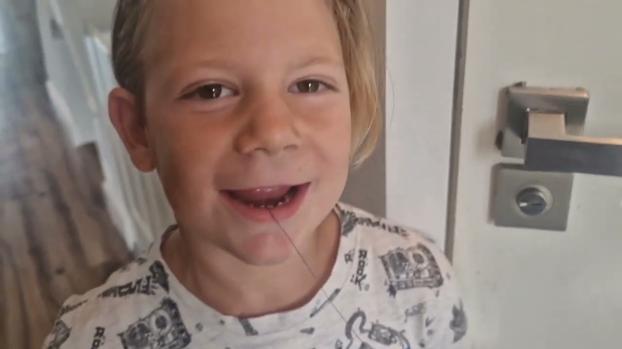We trekken Hayden z'n  wiebel tand eruit door de deur dicht te gooien met een touwtje aan zijn tand