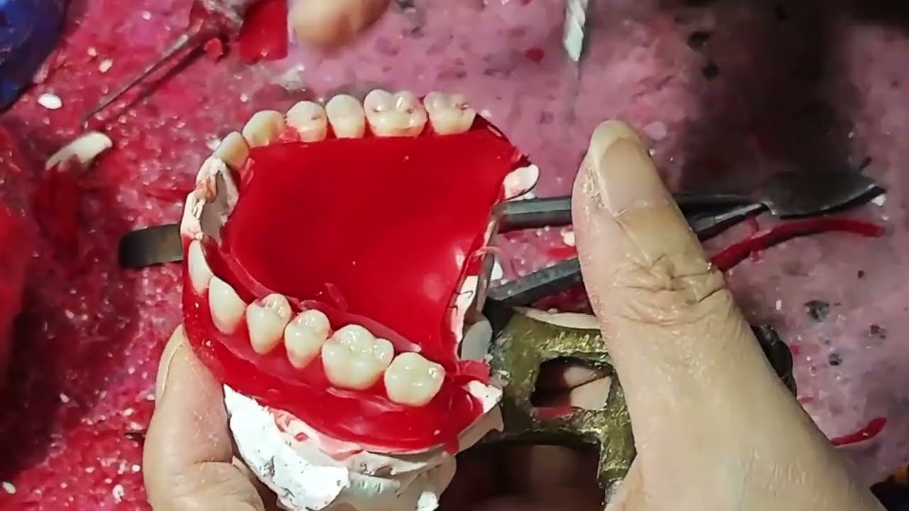 Behind the Scenes: Denture Gum Fabrication (Ultra Realistic)#SatisfyingDental#DentureGum#DentureBase