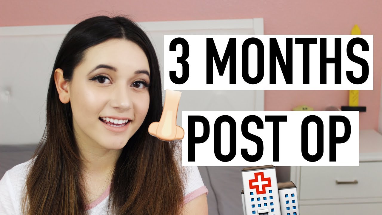 3 MONTH NOSE JOB UPDATE (RHINOPLASTY + SEPTOPLASTY)| AmyCrouton