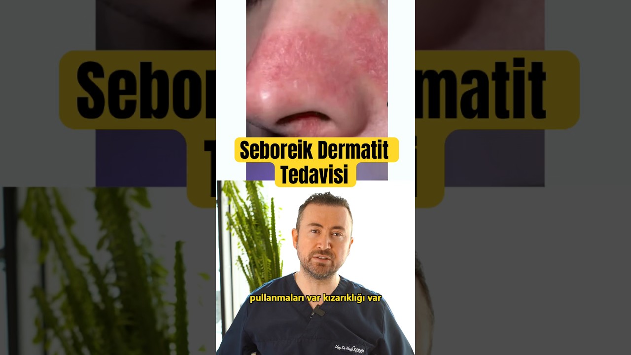 Seboreik Dermatit Tedavisi
