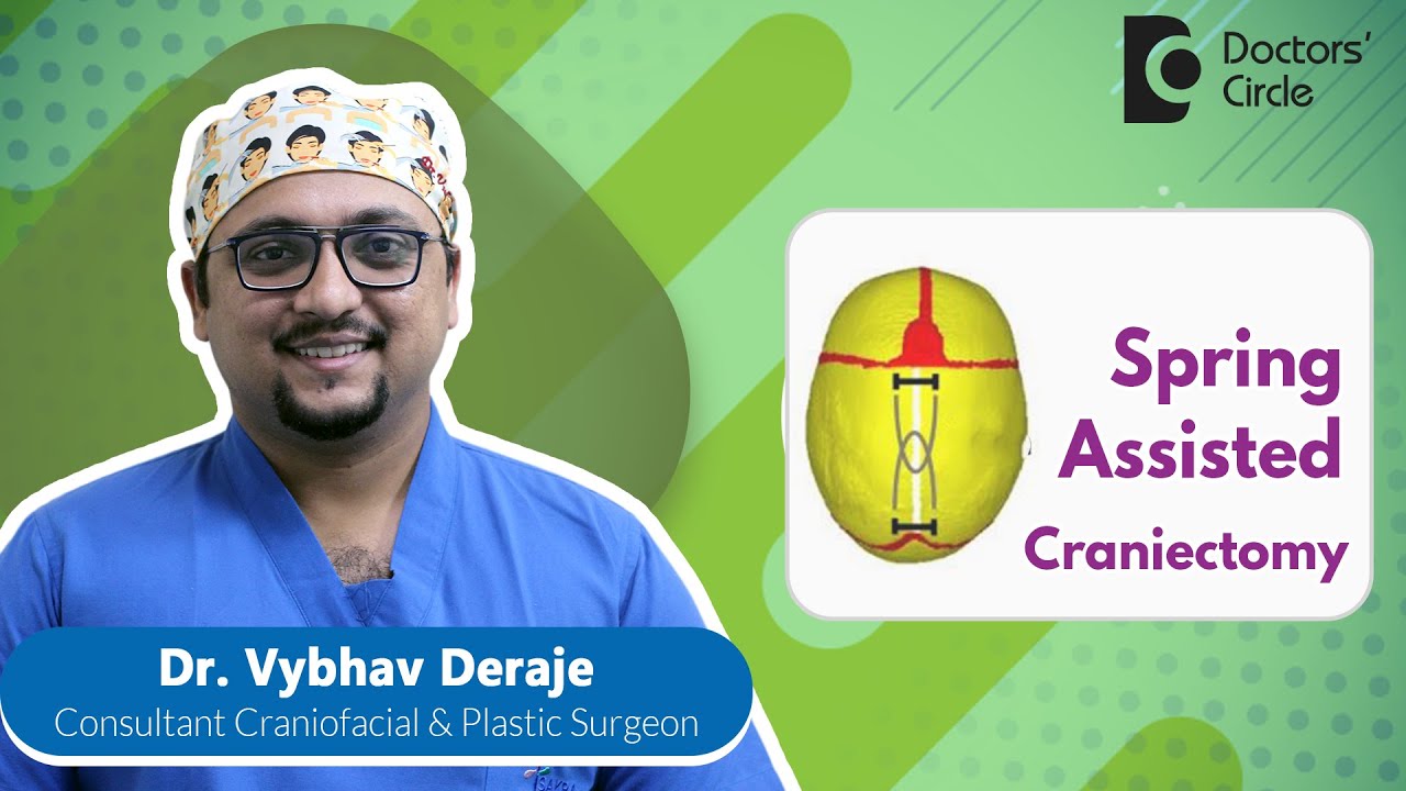 Spring Assisted Cranial Expansion For Abnormal Head Shape #newborn -Dr.Vybhav Deraje|Doctors' Circle