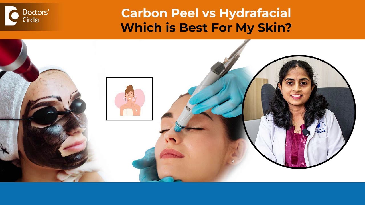 Skin Whitening | Skin Glow with CARBON PEEL & HYDRAFAClAL for #skincare| Skin Laser-Dr.Shubha Kesari