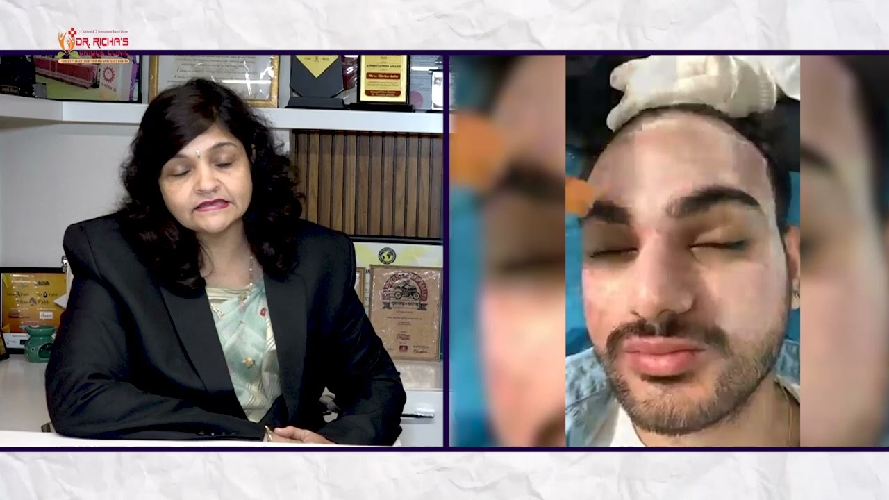Advanced Skin Treatment | Laser Treatment | Carbon Laser | IPL Laser | Episode 19