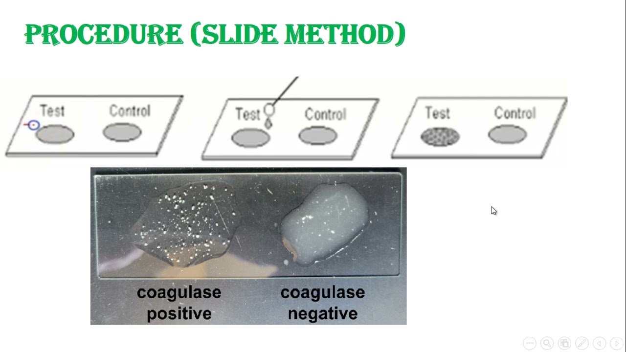 Practical Diagnostic Microbiology 1 -Lab11 Coagulase Test