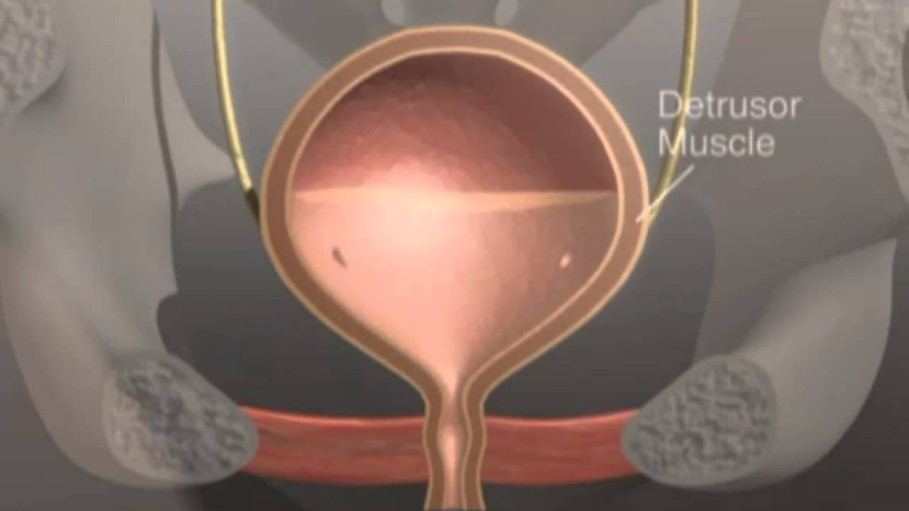 Bladder Health - What is Overactive Bladder?