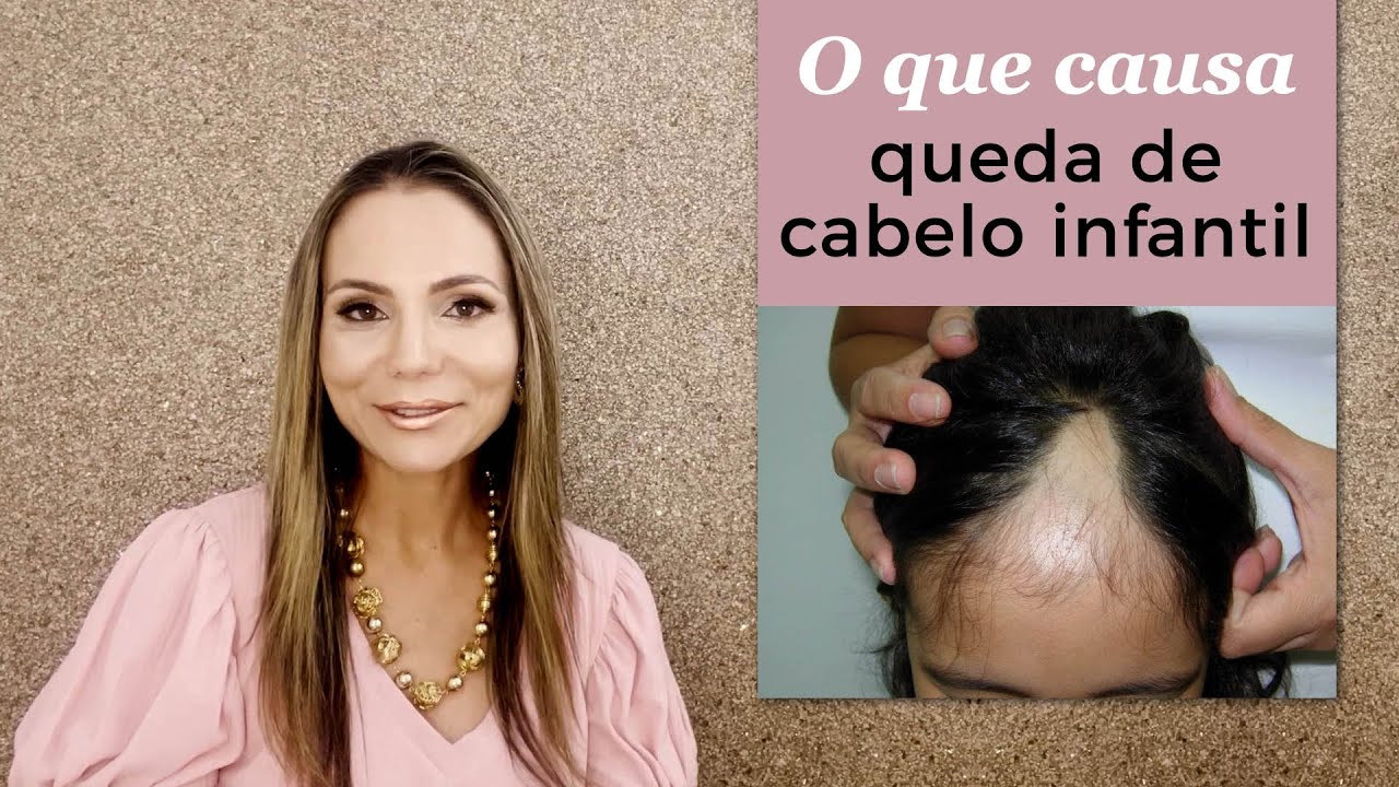 Por que o cabelo da criança cai?