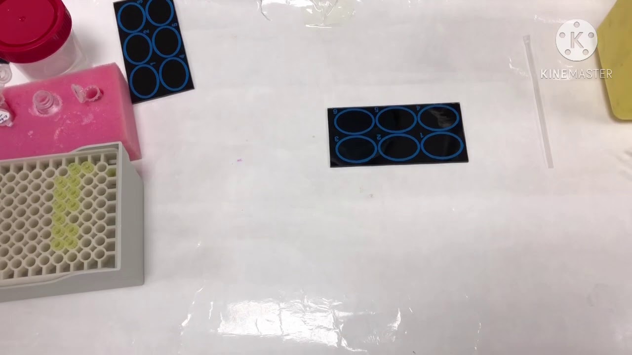 Latex Agglutination Test for Toxoplasma gondii | Immunological Lab 🧪.