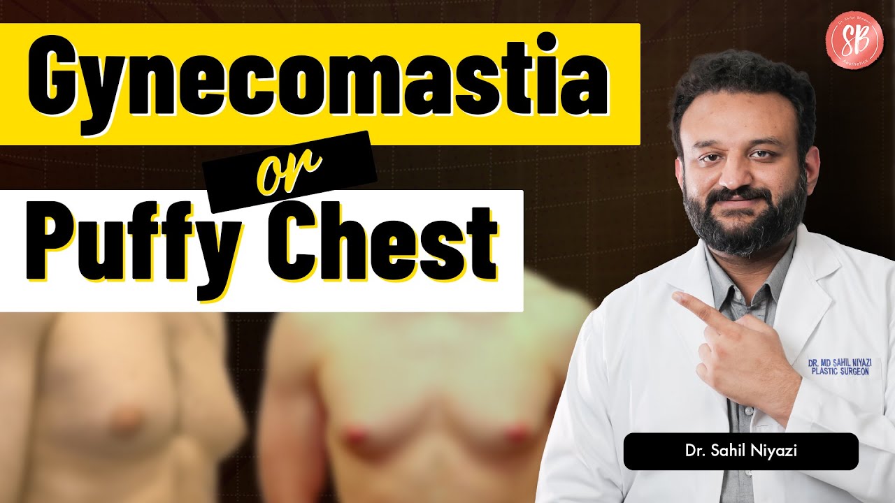 Gynecomastia symptoms & treatment | Gynecomastia Surgery Cost in Delhi NCR, Gurugram | SB Aesthetics