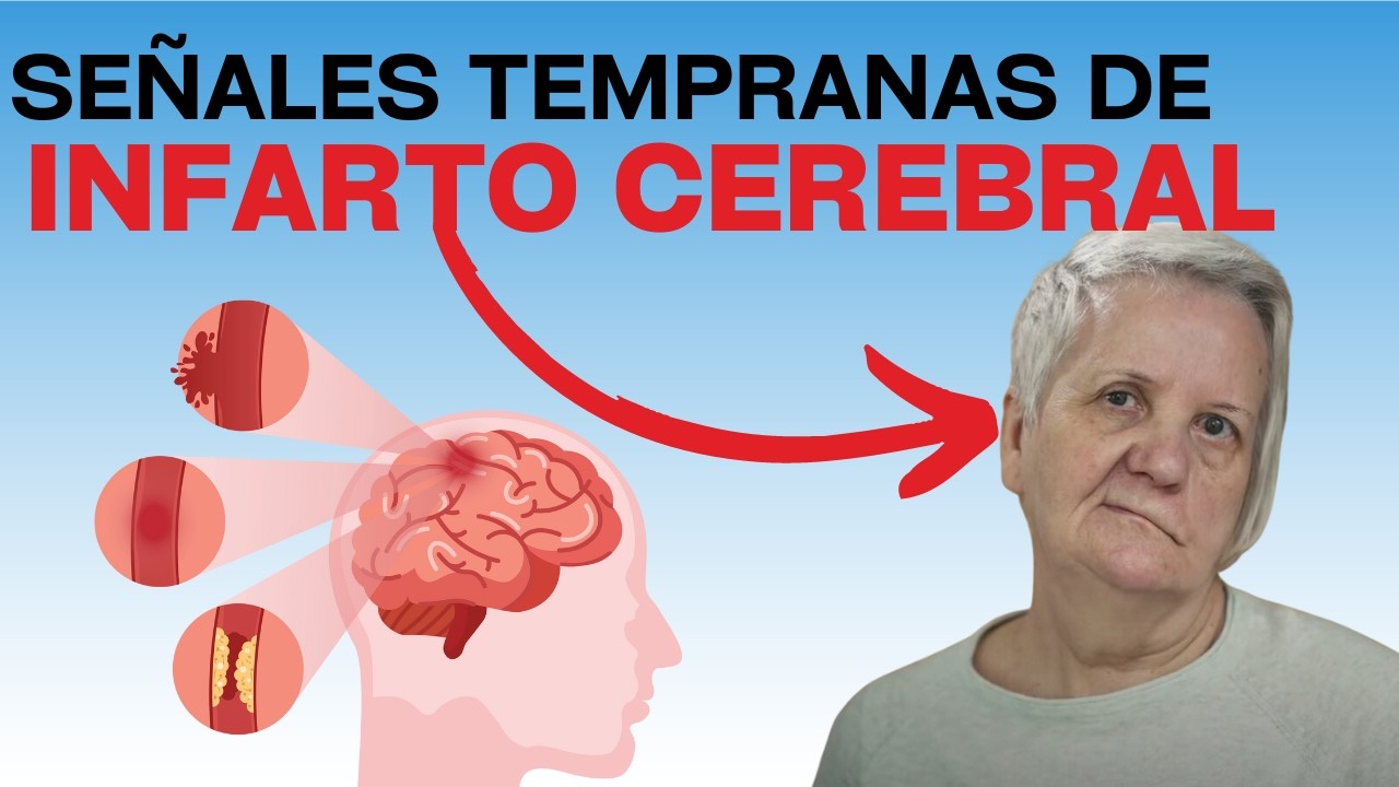 10 Señales de que vas a tener un infarto cerebral