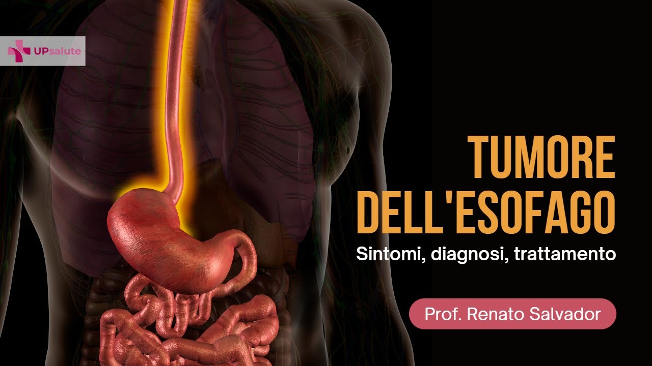 Tumore dell'esofago - Professore Renato Salvador - UPsalute Channel