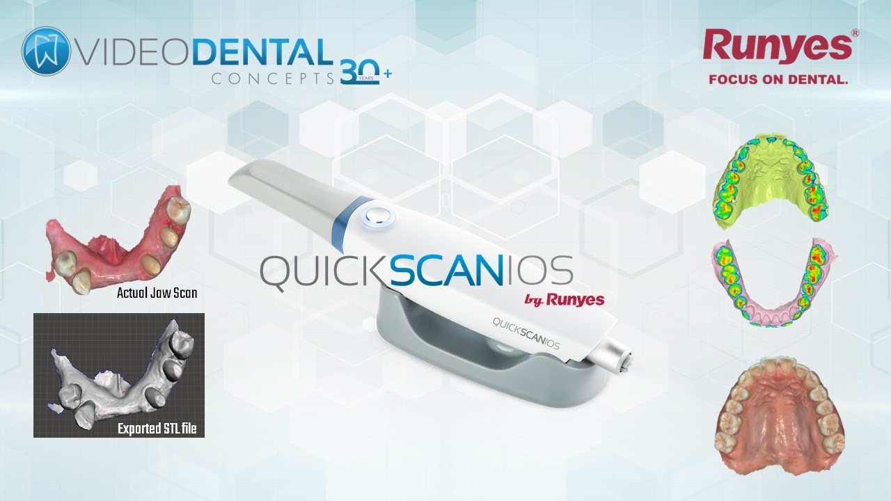 Check Out the NEW QuickScan IOS v2 by Runyes, the next generation 3D intraoral scanner.