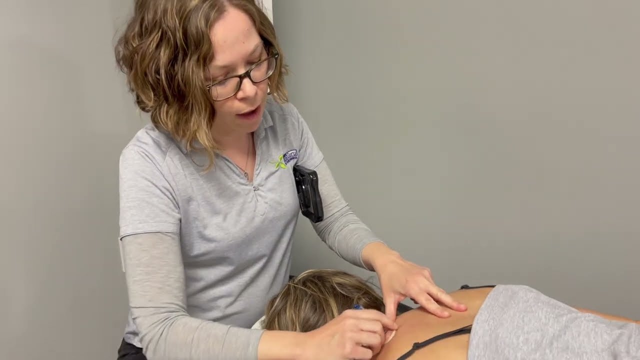 Cupping for Muscle Tension and Headaches Rehab Guru Physical Therapy Omaha
