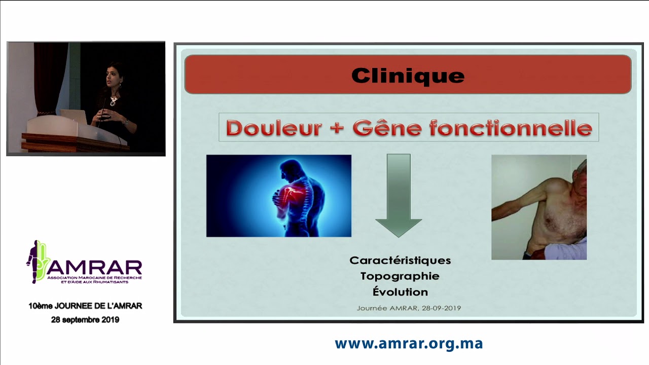 AMRAR - Rééducation de l'épaule douloureuse, Samia KARKOURI - 280919