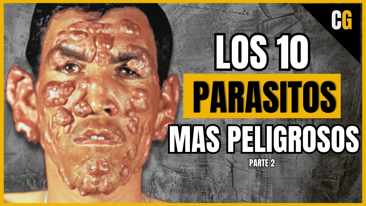 Los 10 PARASITOS m&aacute;s PELIGROSOS - Explicados por un M&eacute;dico - PARTE 2