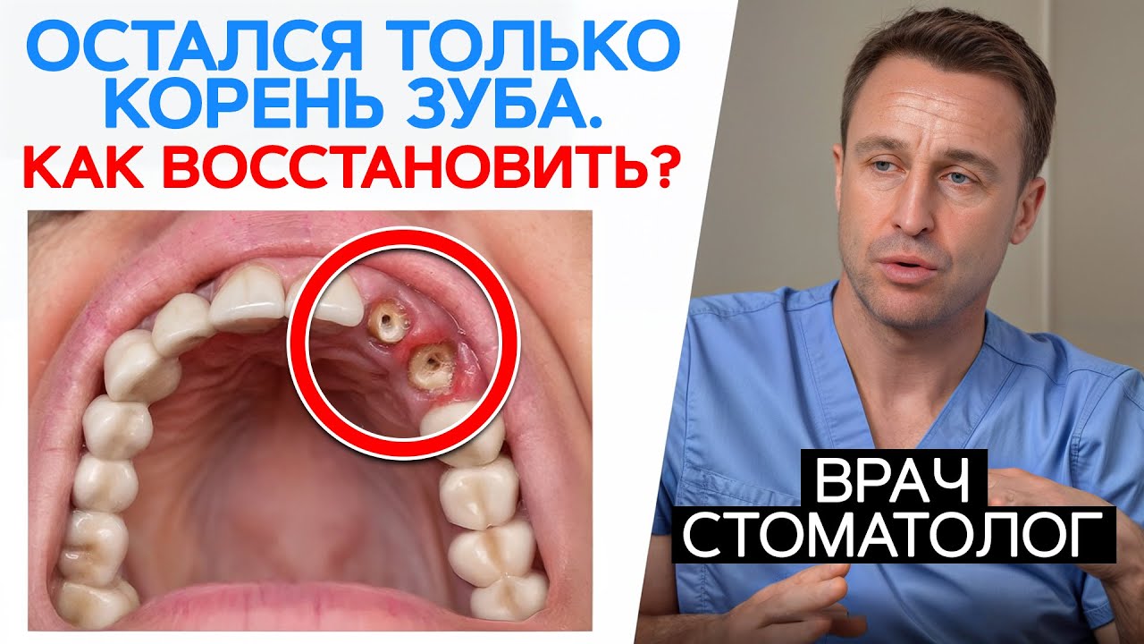 Почему зубы ломаются и как этого избежать? / Простые советы стоматолога