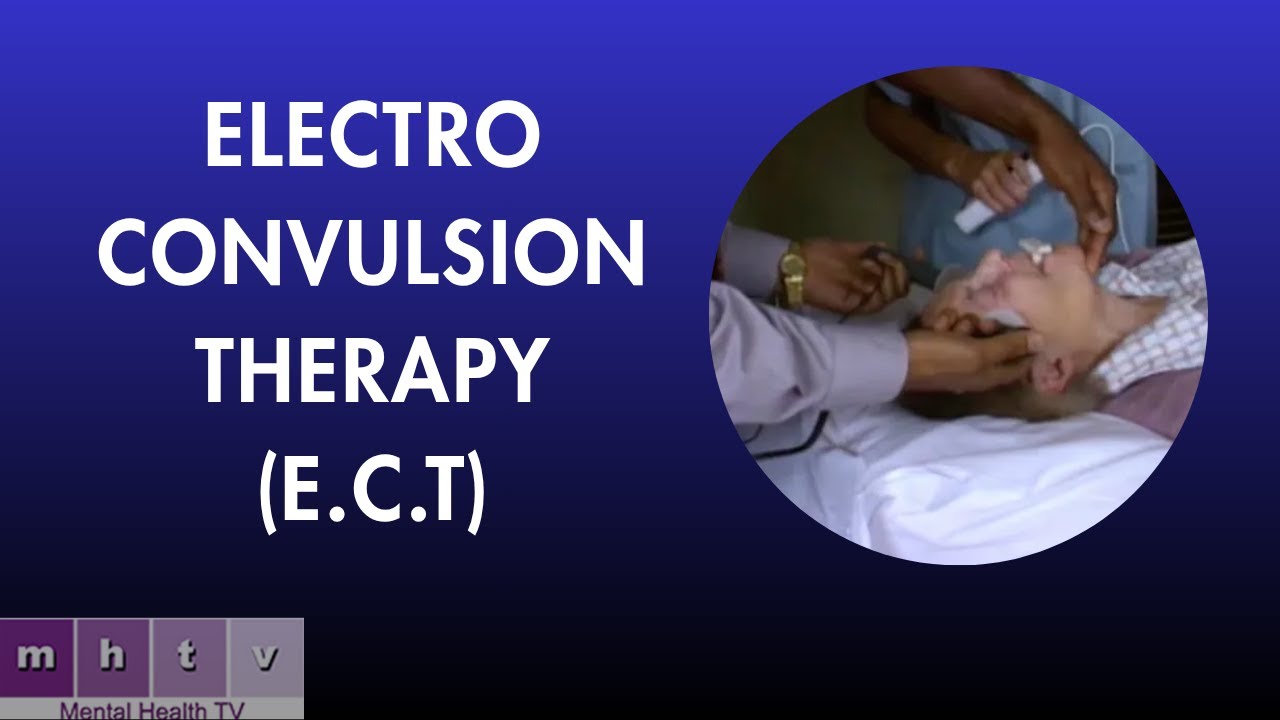 Electro Convulsion Therapy (E.C.T)
