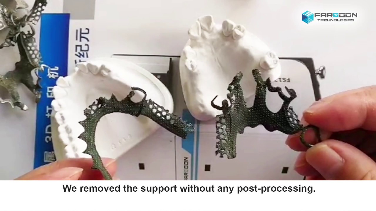 3D Printed Removable Partial Denture (RPD) by Farsoon FS121M Machine