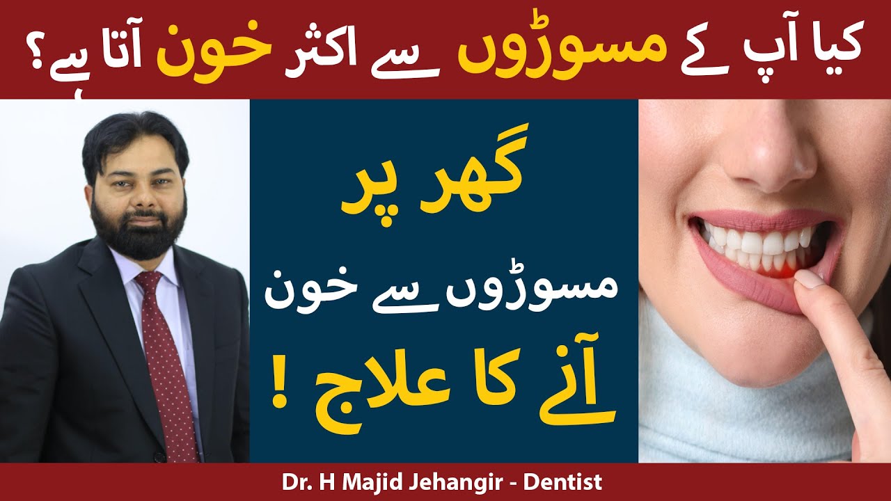 Gum Bleeding Treatment At Home In Urdu/Hindi | Danton Se Khoon Aana | Masoro Se Khoon Aane Ka Ilaj