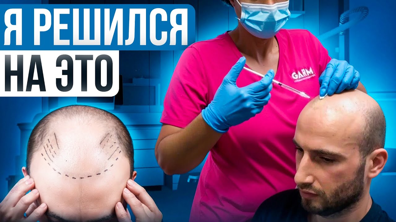 Ген терапия отоблысения на себе: половина головы — плацебо (100 уколов в скальп) Проспера, Гондурас