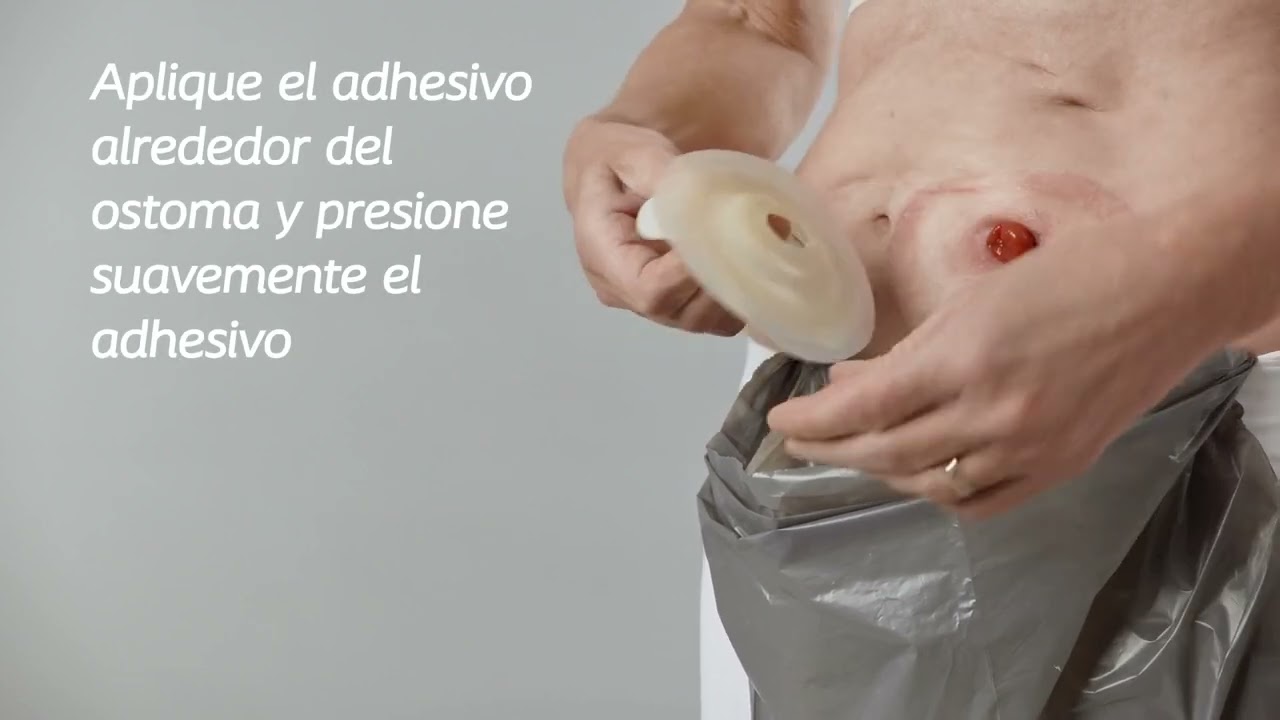 SenSura Mio Convex - Acople click Bolsa Abierta