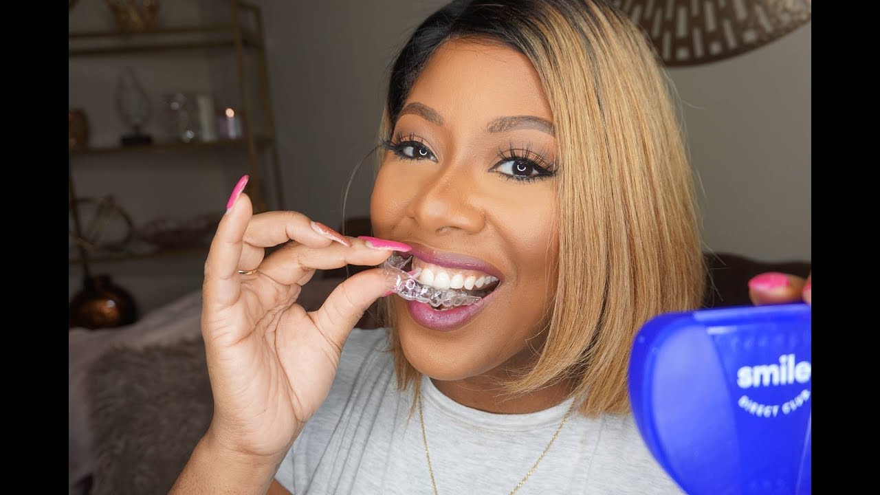 My SmileDirectClub Aligners Have Arrived!!  | MakeupMesha