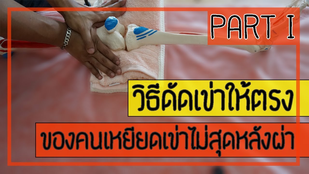 [คลิป 82] ดัดเข่าให้ตรง ในคนไข้เข่าติดหลังผ่าตัด (PART 1)