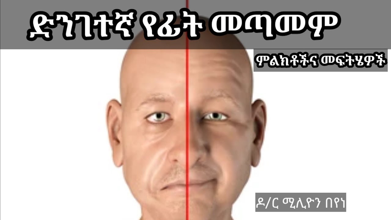 በድንገት የፊት መዞር/መጣመም /Bell's palsy አጋላጭ ምክንያቶችና፣መፍትሆዎች፣ጥንቃቄ