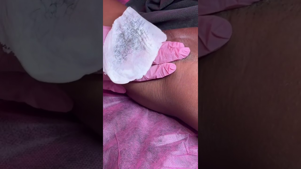 Underarm wax using Waxness hard wax Russian Pearl 🤍🤍