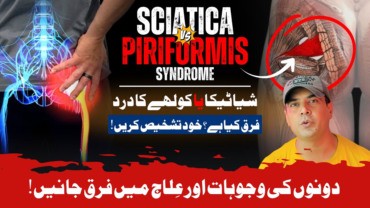 Sciatica vs Piriformis Syndrome | Know the Difference? | Dr. Naseem Abbas