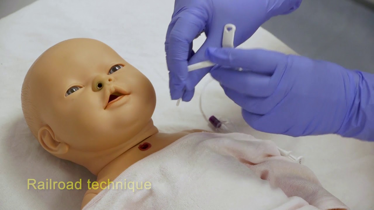 Management of an unsuccessful tracheostomy change