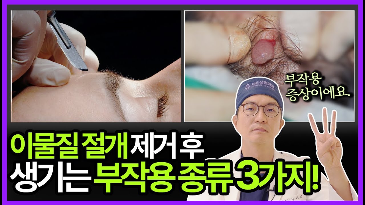 필러나 이물질을 절개로 제거하면 안됩니다.｜#필러제거 #이물질제거｜フィラーや異物、切開で除去してはいけません