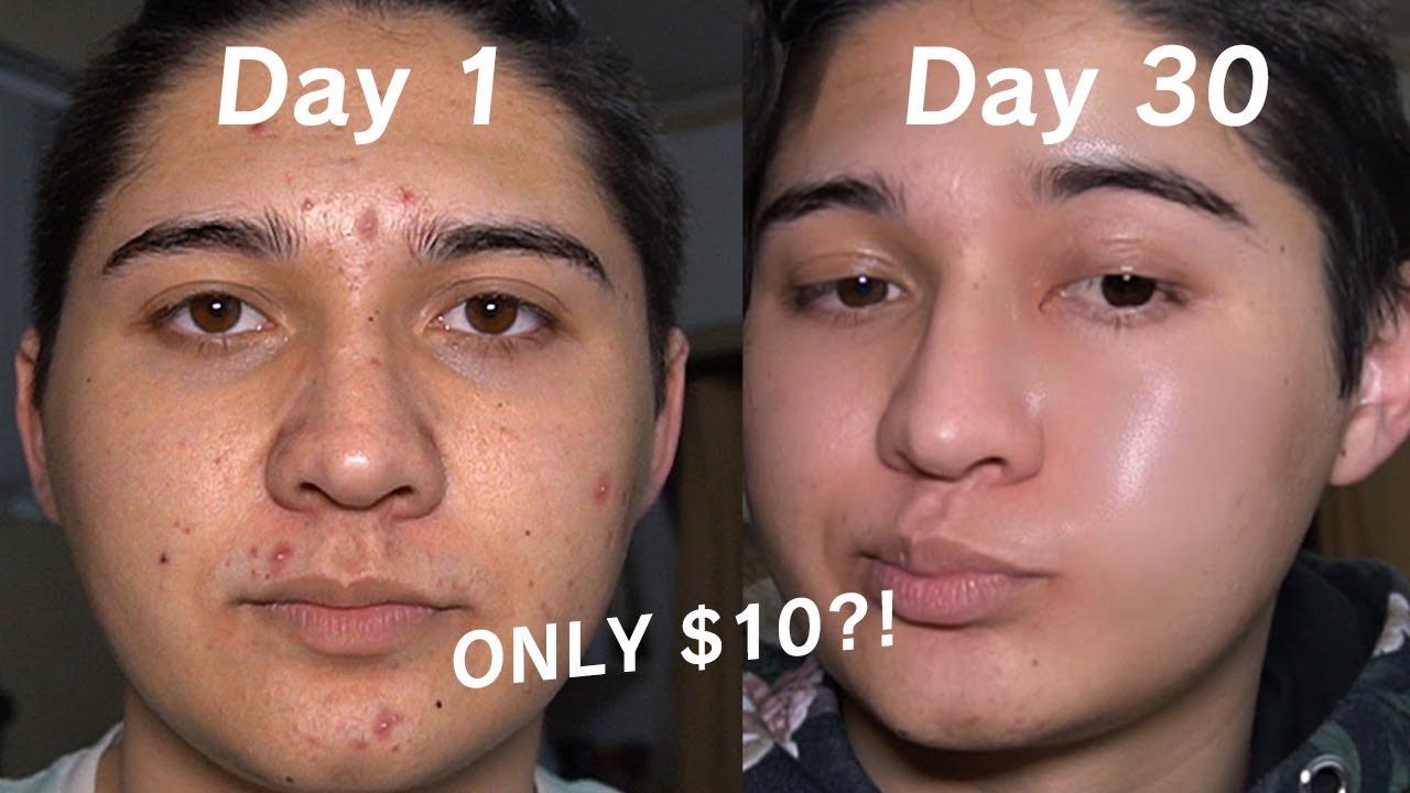 Reviewing Aliexpress skincare for a month (it cleared my skin 😲)