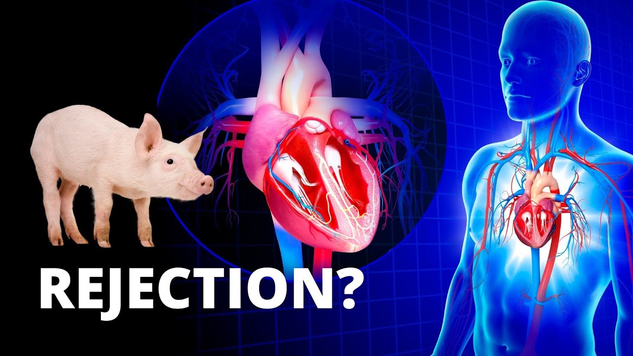 Is it Possible to Reject a Pig Valve in Your Heart?