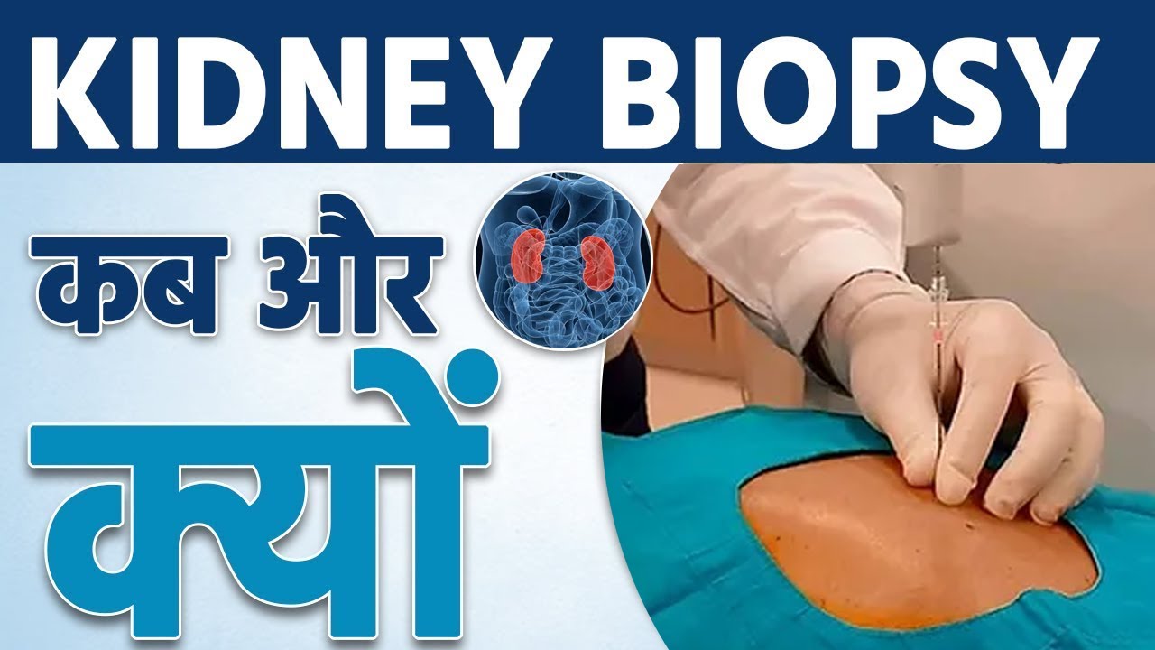 क्या होती हैं Kidney Biopsy | Kaise Hoti Hai Kidney Biopsy | Sai Sanjivani Delhi