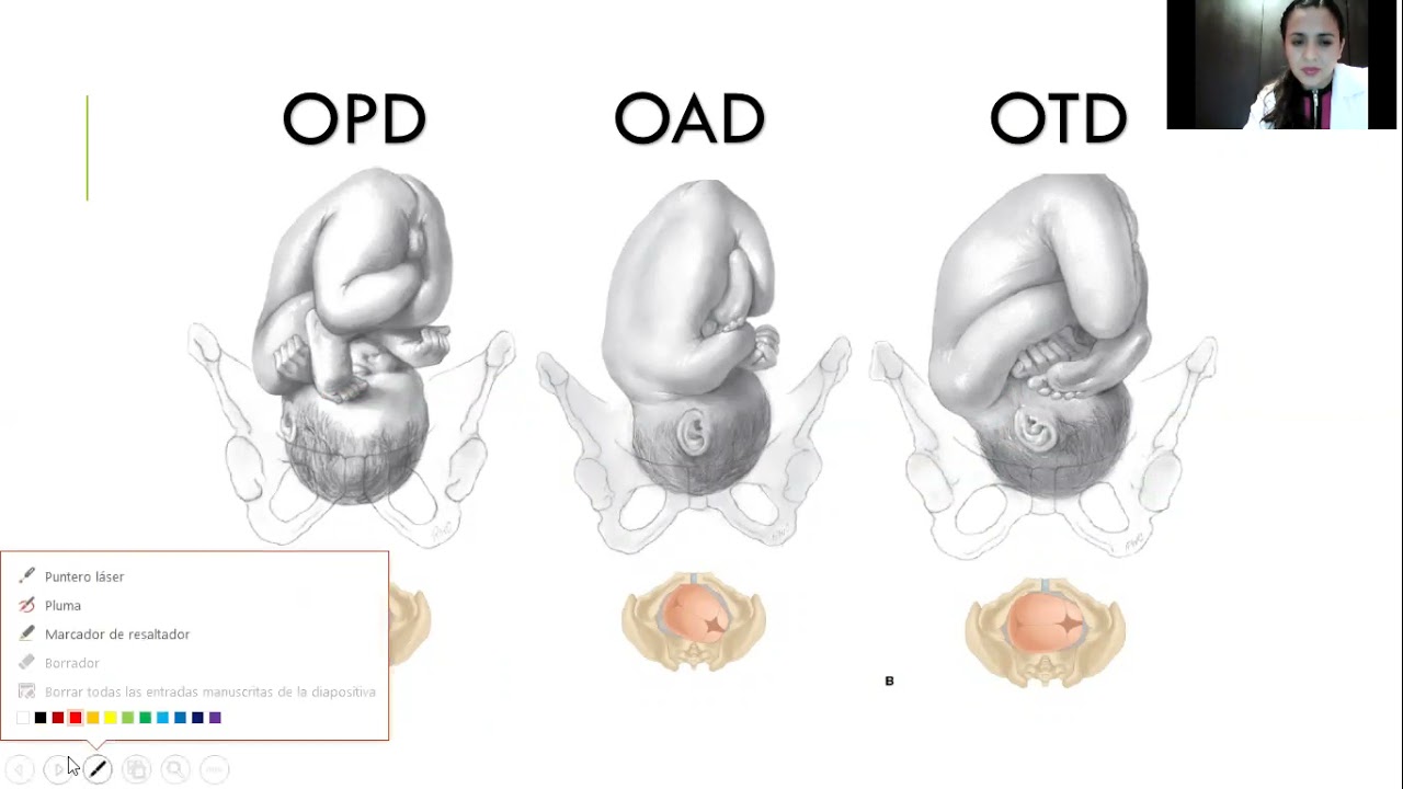 MODULO DE GINECOOBSTETRICIA: MECANISMOS DEL TRABAJO DE PARTO