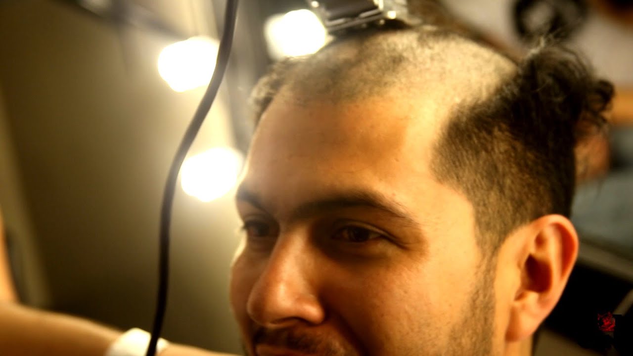 PEPEPROBLEMAS RAPA A NETZA