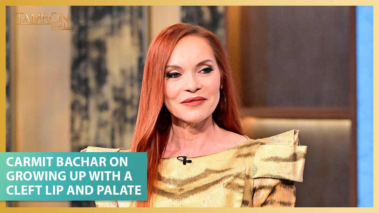 Pussycat Doll Star Carmit Bachar Details Growing Up With a Cleft Lip and Palate