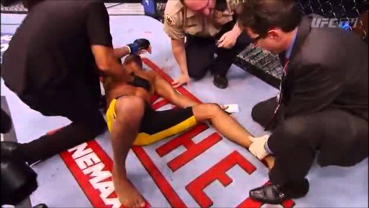 Anderson Silva suffers broken leg against Chris Weidman