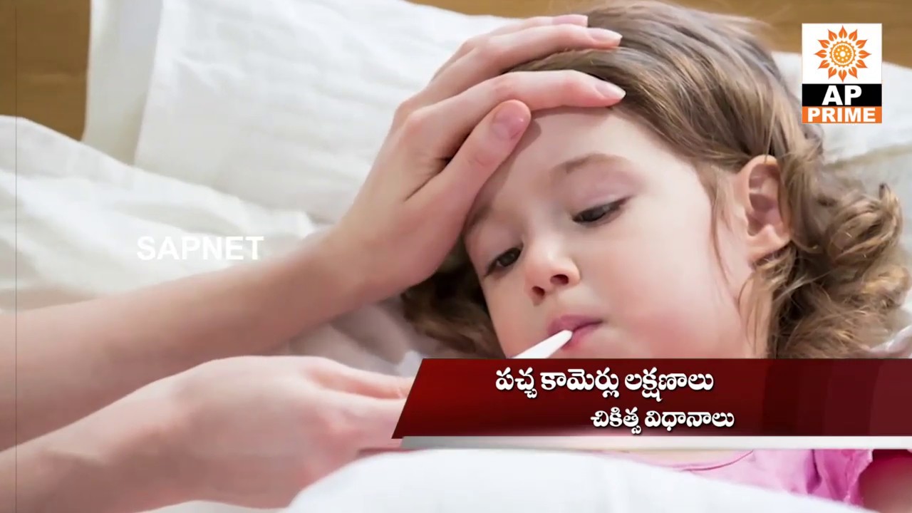 Health Guide | Jaundice Treatment | EP 56 | AP Prime Tv | SAPNET