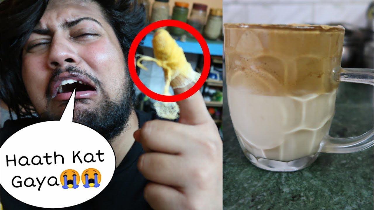 What Happened to My HAND😱😭 | Dalgona Coffee