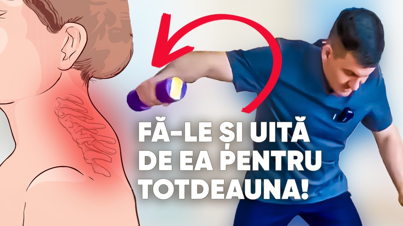 Scapă de cocoașa de pe gât PE VIAȚĂ!