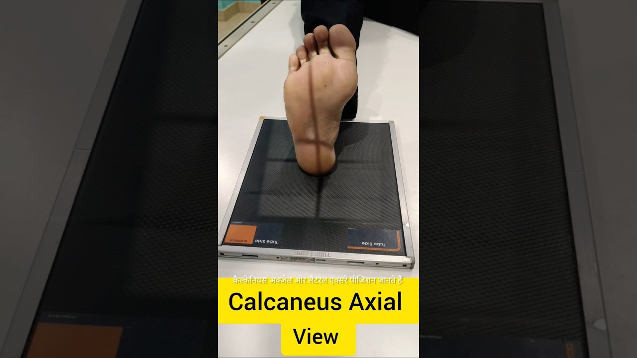 #xray #calcaneus Axial & Lat View #shorts #radiology