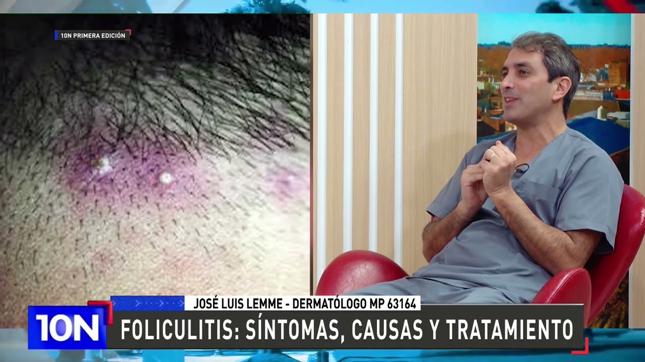 FOLICULITIS 👩‍🦰