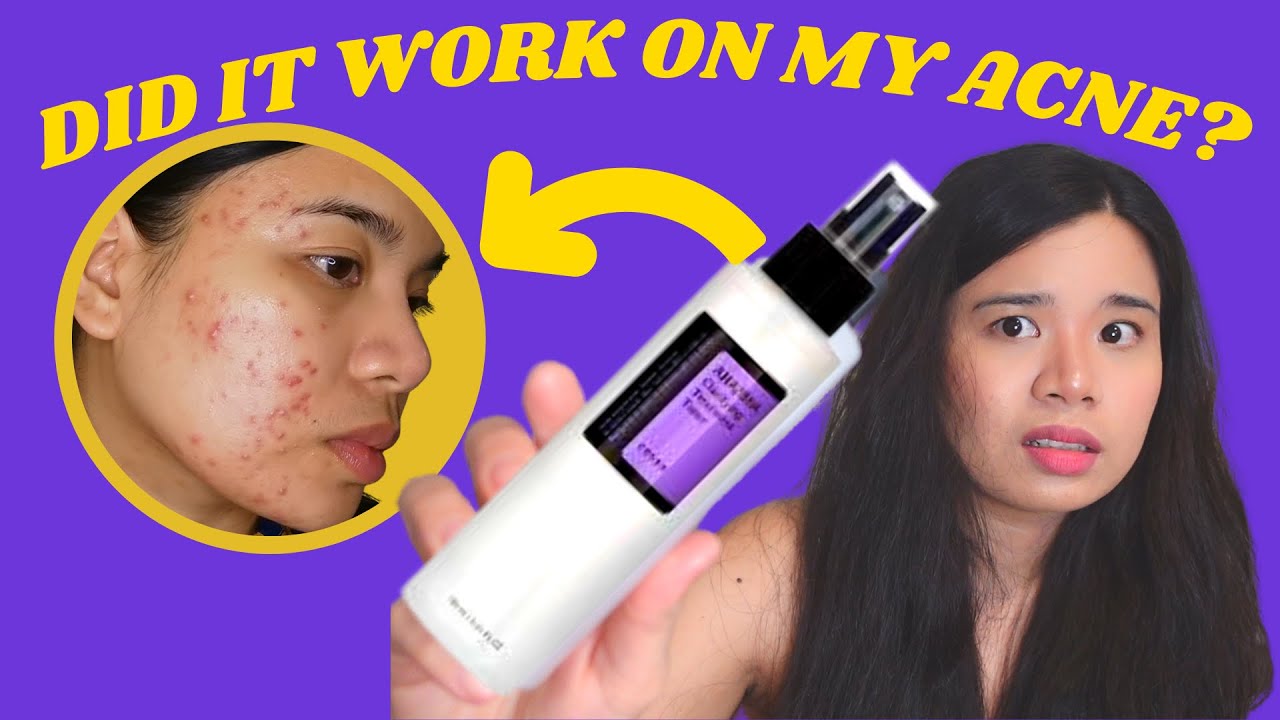 COSRX | РЕЗУЛЬТАТЫ ЗА 2 МЕСЯЦА + ЧАСТО ЗАДАВАЕМЫЕ ВОПРОСЫ | Очищающий тоник с AHA/BHA для кожи с ...