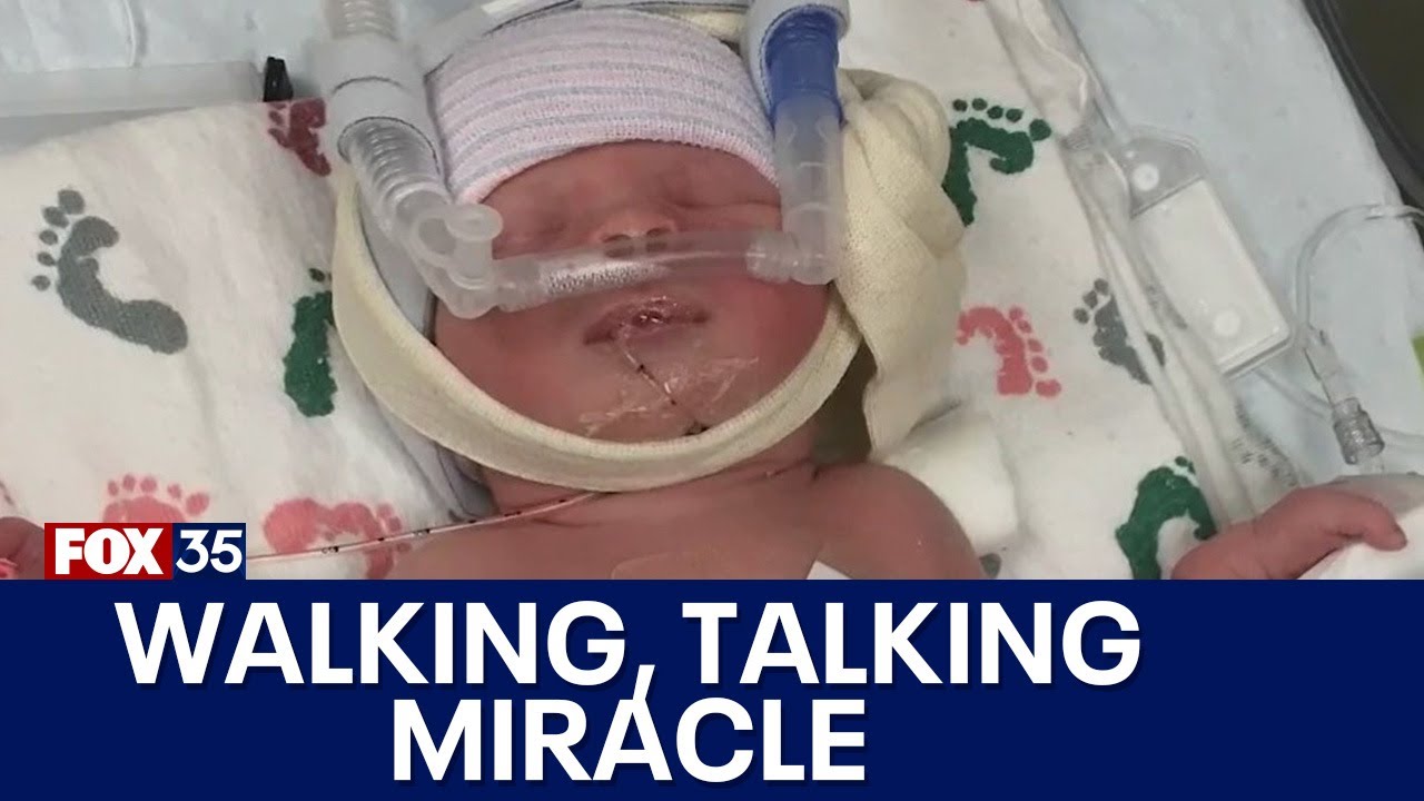 Baby born with part of its skull missing, exposing brain: 'A lot of scary moments