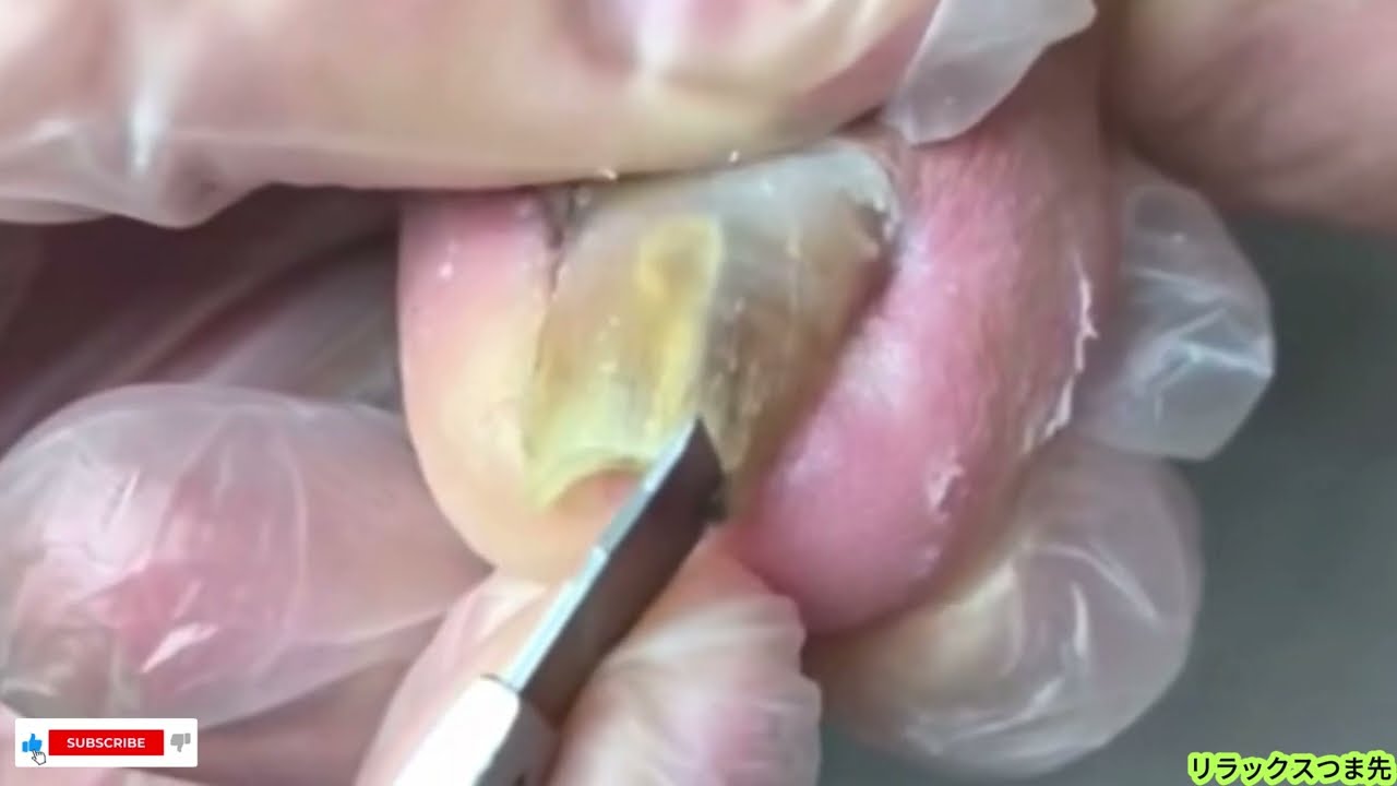 ASMR 爪の奥に潜む汚れを除去 &ndash; 見たら止まらない足のケア