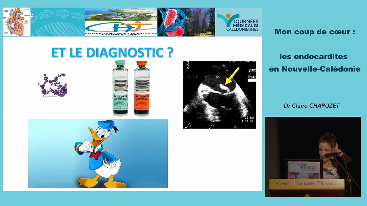 Les endocardites infectieuses
